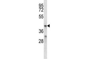 MFSD2B antibody western blot analysis in ZR-75-1 lysate. (MFSD2B 抗体  (AA 383-411))