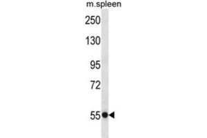 Western Blotting (WB) image for anti-Ubiquitin Specific Peptidase 40 (USP40) antibody (ABIN2997408) (USP40 抗体)