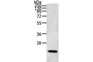 Western Blot analysis of Human fetal brain tissue using CDC42 Polyclonal Antibody at dilution of 1:200 (CDC42 抗体)