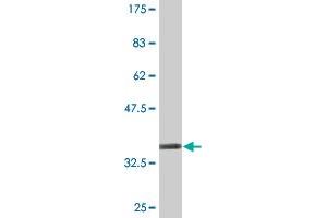 Western Blot detection against Immunogen (35. (PHACTR3 抗体  (AA 92-179))