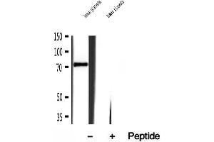 Western blot analysis of extracts of human placenta tissue, using Kindlin 2 antibody. (FERMT2 抗体  (C-Term))