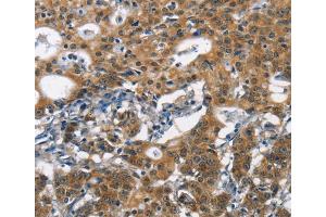 Immunohistochemistry (IHC) image for anti-Deleted in Colorectal Carcinoma (DCC) antibody (ABIN2432000) (DCC 抗体)