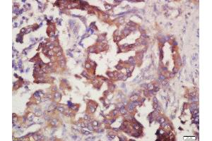 Immunohistochemistry (Paraffin-embedded Sections) (IHC (p)) image for anti-Prostaglandin E Receptor 4 (Subtype EP4) (PTGER4) (AA 151-250) antibody (ABIN1387963)