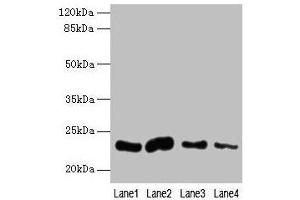 Western blot All lanes: CLEC3A antibody at 0. (CLEC3A 抗体  (AA 23-197))