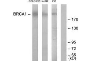 Western blot analysis of extracts from COLO205/HepG2 cells, treated with serum 20% 15', using BRCA1 (Ab-1524) Antibody. (BRCA1 抗体  (AA 1491-1540))