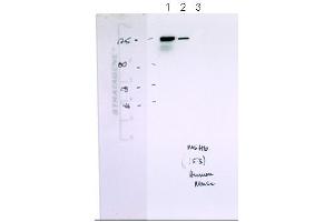 Western Blotting (WB) image for anti-MutS Homolog 6 (E. Coli) (MSH6) (N-Term) antibody (ABIN2776759)