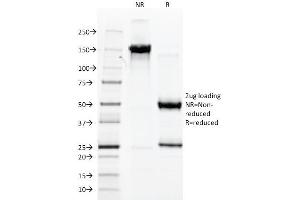 SDS-PAGE Analysis Purified vWF Mouse Monoclonal Antibody (3E2D10). (VWF 抗体  (AA 845-949))