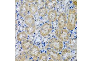 Immunohistochemistry of paraffin-embedded mouse kidney using  antibody (ABIN6127321, ABIN6136446, ABIN6136448 and ABIN6216005) at dilution of 1:100 (40x lens). (ACP1 抗体  (AA 1-158))