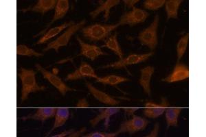 Immunofluorescence analysis of L929 cells using UCP1 Polyclonal Antibody at dilution of 1:100. (UCP1 抗体)