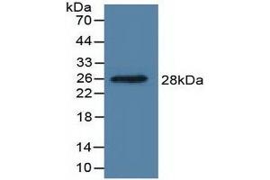Detection of Recombinant DDAH1, Human using Polyclonal Antibody to Dimethylarginine Dimethylaminohydrolase 1 (DDAH1) (DDAH1 抗体  (AA 20-215))