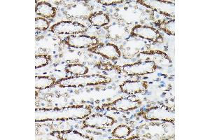 Immunohistochemistry of paraffin-embedded rat kidney using Phospho-FOXO3A-S425 Rabbit pAb (ABIN7267246) at dilution of 1:250 (40x lens). (FOXO3 抗体  (pSer425))