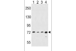 Western blot analysis in Hela(lane 1),A549(lane 2),K562(lane 3),MDA-MB435(lane 4) cell line lysates (35ug/lane). (ALOX15 抗体  (C-Term))