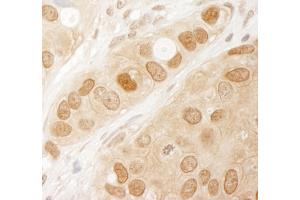 Immunohistochemistry (IHC) image for anti-V-Akt Murine Thymoma Viral Oncogene Homolog 1 (AKT1) (AA 25-75) antibody (ABIN7454546)