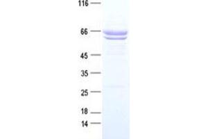 Western Blotting (WB) image for PTK7 Protein tyrosine Kinase 7 (PTK7) protein (DYKDDDDK Tag) (ABIN2730092)