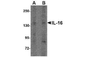 Western blot analysis of IL-16 in rat brain tissue lysate with AP30407PU-N IL-16 antibody at (A) 1 µg/ml and (B) 2 μg/ml.