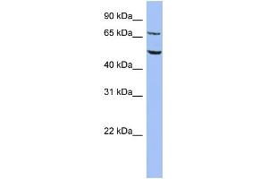 WB Suggested Anti-REPIN1 Antibody Titration:  0. (REPIN1 抗体  (Middle Region))