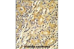 Immunohistochemistry (Paraffin-embedded Sections) (IHC (p)) image for anti-Cytochrome P450, Family 51, Subfamily A, Polypeptide 1 (CYP51A1) (AA 474-503), (C-Term) antibody (ABIN652819)
