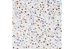 Immunohistochemistry of paraffin-embedded rat ovary using A Rabbit pAb (ABIN6129868, ABIN6136479, ABIN6136480 and ABIN6221034) at dilution of 1:100 (40x lens). (BAF53A 抗体  (AA 1-280))