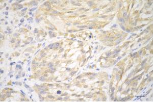 anti-Cyclin-Dependent Kinase 2 (CDK2) antibody