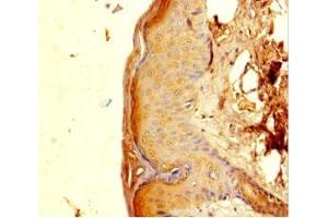 Immunohistochemistry of paraffin-embedded human skin tissue using ABIN7162782 at dilution of 1:100 (PGLYRP4 抗体  (AA 18-317))