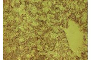 Immunohistochemistry (IHC) image for anti-delta-Like 1 Homolog (Drosophila) (DLK1) antibody (ABIN1449213) (DLK1 抗体)