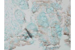 Immunohistochemistry analysis using Rabbit Anti-ERK1 Polyclonal Antibody . (ERK1 抗体  (FITC))