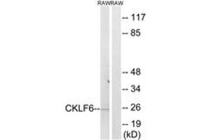 Western Blotting (WB) image for anti-CKLF-Like MARVEL Transmembrane Domain Containing 6 (CMTM6) (AA 131-180) antibody (ABIN2890222) (CMTM6 抗体  (AA 131-180))