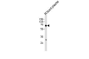 FGA Antibody (N-term) (ABIN390830 and ABIN2841057) western blot analysis in human blood plasma tissue lysates (35 μg/lane). (FGA 抗体  (N-Term))