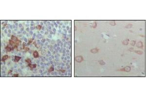 Immunohistochemical analysis of paraffin-embedded human lymph node (left) and brain (right), showing cytoplasmic localization with DAB staining using EhpB6 mouse mAb. (EPH Receptor B6 抗体  (AA 601-750))