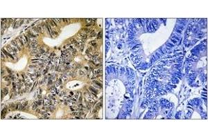 Immunohistochemistry (IHC) image for anti-Eukaryotic Translation Initiation Factor 4E Binding Protein 1 (EIF4EBP1) (AA 36-85), (pThr70) antibody (ABIN1532119)
