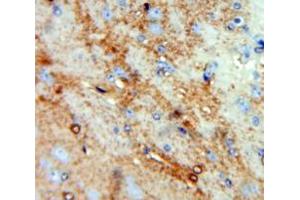 Used in DAB staining on fromalin fixed paraffin-embedded Brain tissue (CCL4L1 抗体  (AA 24-92))