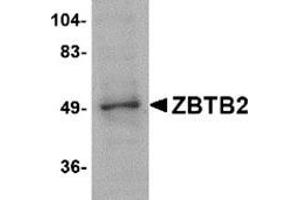 Western blot analysis of ZBTB2 in PC-3 cell lysate with this product at 1 μg/ml.