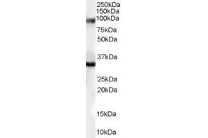 Western Blotting (WB) image for anti-Bone Morphogenetic Protein 8A (BMP8A) (Middle Region) antibody (ABIN2789951) (BMP8A 抗体  (Middle Region))