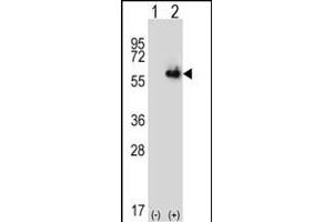 Western blot analysis of ALDH4A1 (arrow) using rabbit polyclonal ALDH4A1 Antibody (Center) (ABIN392357 and ABIN2841996). (ALDH4A1 抗体  (AA 288-314))