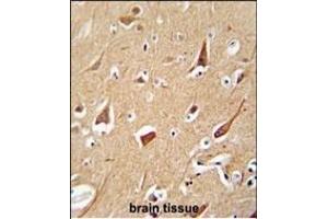 Immunohistochemistry (Paraffin-embedded Sections) (IHC (p)) image for anti-Zinc Finger, FYVE Domain Containing 28 (ZFYVE28) (AA 604-633), (C-Term) antibody (ABIN654534)