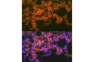 Immunofluorescence analysis of rat lung using Mesothelin Rabbit mAb (ABIN7268478) at dilution of 1:100 (40x lens). (Mesothelin 抗体)