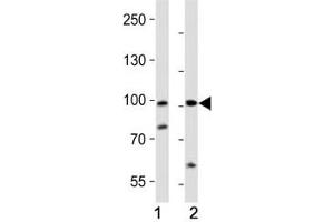 Western blot analysis of lysate from (1) human A2058 and (2) rat PC-12 cell line using PROX1 antibody at 1:1000. (PROX1 抗体  (AA 492-522))