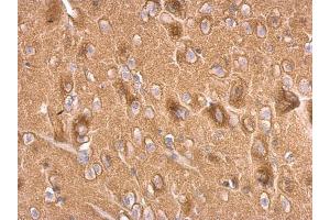 IHC-P Image Synaptophysin antibody detects Synaptophysin protein at on rat fore brain by immunohistochemical analysis. (Synaptophysin 抗体  (C-Term))