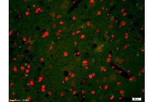 Formalin-fixed and paraffin-embedded rat brain labeled with Anti-Phospho-HER3(Tyr1328) Polyclonal Antibody, Unconjugated (ABIN800628) 1:200, overnight at 4°C, The secondary antibody was Goat Anti-Rabbit IgG, Cy3 conjugated used at 1:200 dilution for 40 minutes at 37°C. (ERBB3 抗体  (pTyr1328))