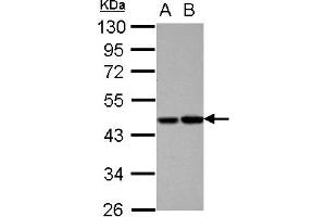 Western Blotting (WB) image for anti-Vitamin K-dependent protein C (PROC) (AA 1-236) antibody (ABIN1500426) (PROC 抗体  (AA 1-236))