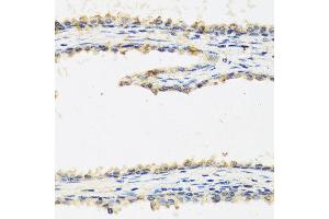 Immunohistochemistry of paraffin-embedded human prostate using SPINT1 antibody at dilution of 1:100 (40x lens). (SPINT1 抗体)