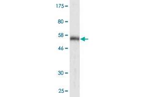 Western Blot detection against Immunogen (58. (CDK2 抗体  (AA 1-298))