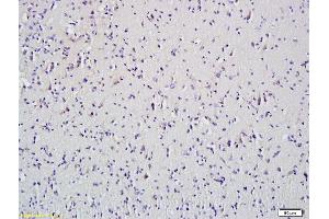 Formalin-fixed and paraffin embedded mouse spleen tissue labeled with Anti-HDAC5 Polyclonal Antibody, Unconjugated (ABIN681043) at 1:200 followed by conjugation to the secondary antibody and DAB staining (HDAC5 抗体)