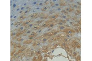 Used in DAB staining on fromalin fixed paraffin- embedded esophagus tissue (FPGT 抗体  (AA 127-377))