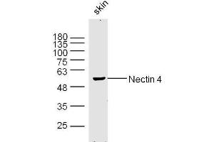 Mouse skin lysates probed with Nectin 4 Polyclonal Antibody, Unconjugated  at 1:300 dilution and 4˚C overnight incubation. (PVRL4 抗体  (AA 151-250))