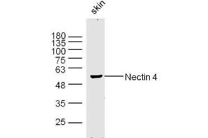 Mouse skin lysates probed with Nectin 4 Polyclonal Antibody, Unconjugated  at 1:300 dilution and 4˚C overnight incubation. (PVRL4 抗体  (AA 151-250))