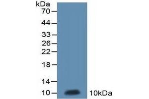 Detection of Recombinant ND5, Rat using Polyclonal Antibody to NADH Dehydrogenase 5 (ND5) (MT-ND5 抗体  (AA 425-562))