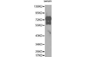 Western Blotting (WB) image for anti-Vitronectin (VTN) (AA 364-478) antibody (ABIN3022358) (Vitronectin 抗体  (AA 364-478))