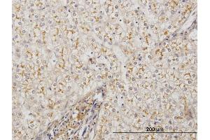 Immunoperoxidase of monoclonal antibody to AMBP on formalin-fixed paraffin-embedded human liver. (AMBP 抗体  (AA 19-352))