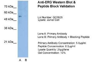 Host:  Rabbit  Target Name:  ERG  Sample Type:  Jurkat  Lane A:  Primary Antibody  Lane B:  Primary Antibody + Blocking Peptide  Primary Antibody Concentration:  1. (ERG 抗体  (Middle Region))